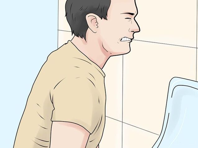 Painful urination is a symptom of an exacerbation of prostatitis in men